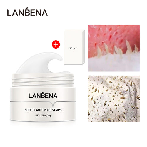 Bye-bye blackheads, hello smooth glowing skin!