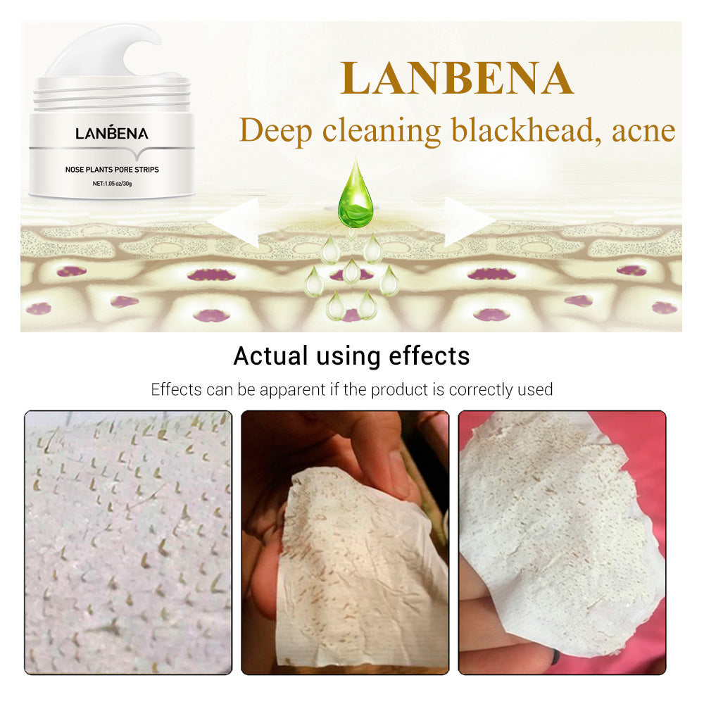 Bye-bye blackheads, hello smooth glowing skin!